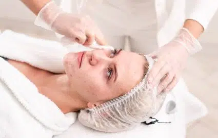 En quoi consiste la subcision-injection des cicatrices d’acné ? | Dr Mayeux | Paris