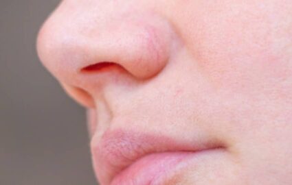 Comment traiter ses rougeurs sans chirurgie ? | Dr Mayeux | Paris