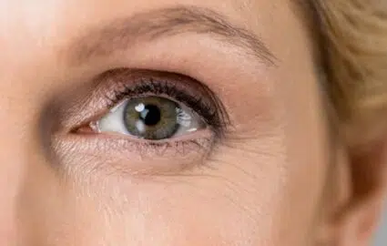 Qu’est-ce que la blépharoplastie médicale | Dr Mayeux | Paris