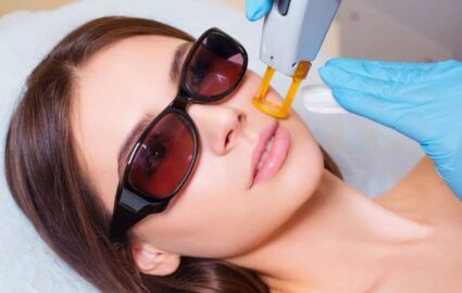 Les poils du visage: Épilation laser, laser Q Switched ou épilation électrique ? | Dr Mayeux | Paris