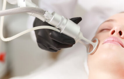 déroulement laser CO2