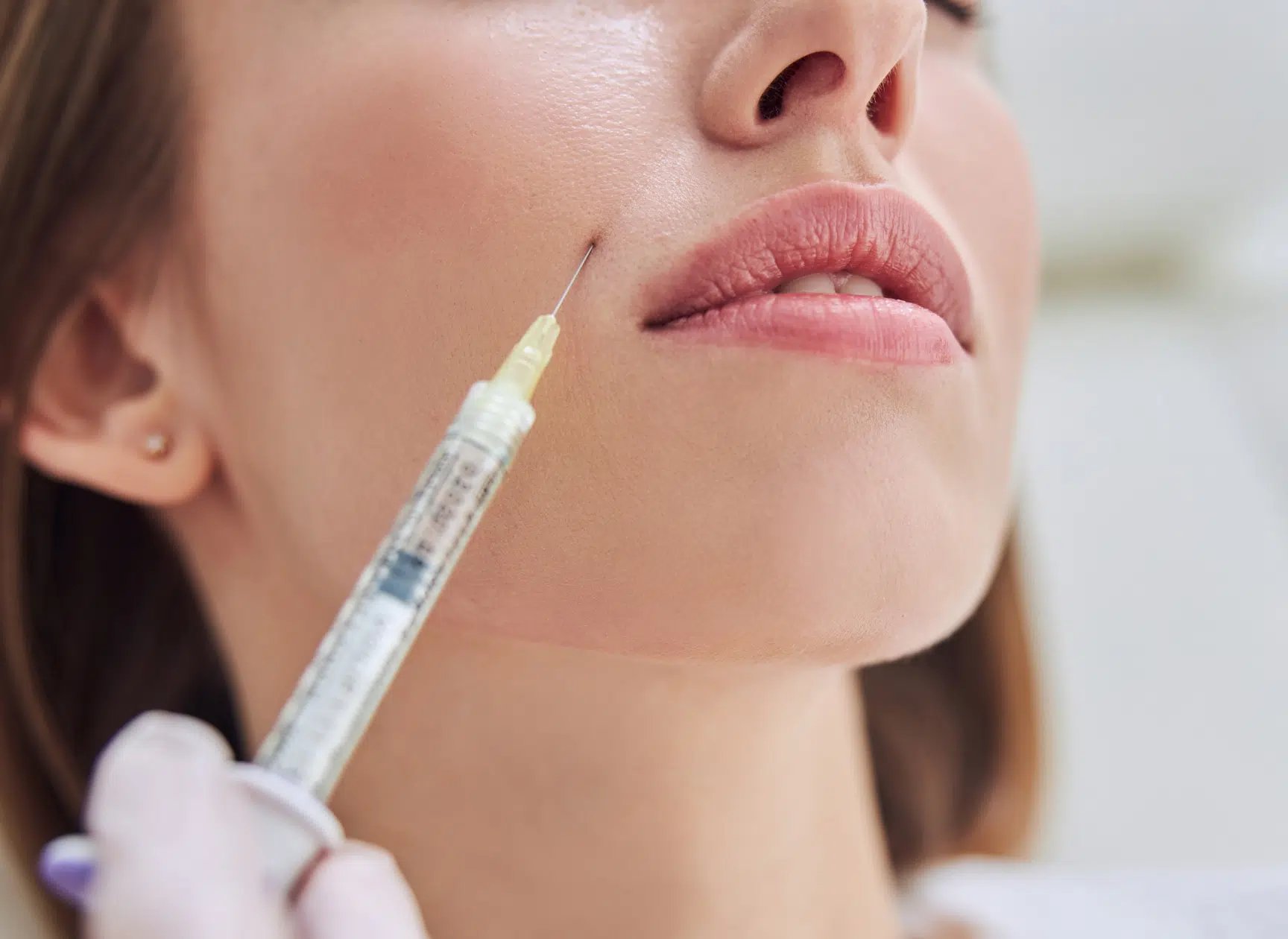 Injection de sculptra - Médecine esthétique | Dr Mayeux